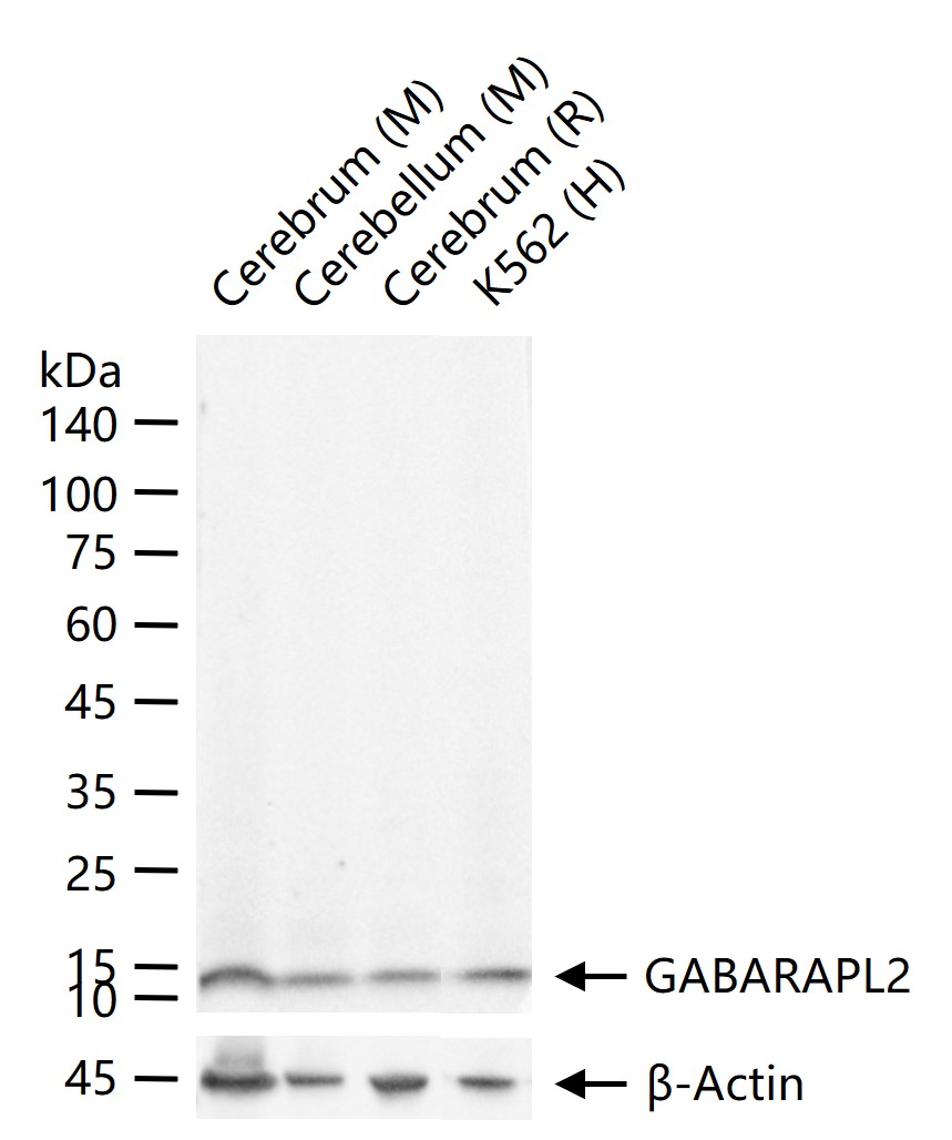 G1氨基丁酸A型受体相似蛋白2重组兔单抗