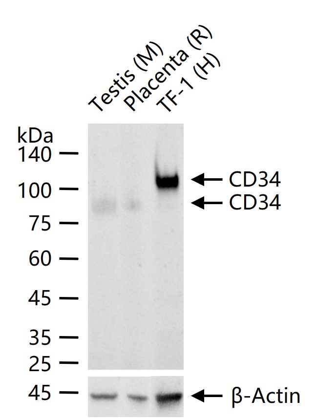 CD34重组兔单抗