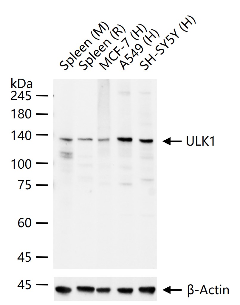 ULK1 Recombinant Rabbit mAb (一抗) | Bioss