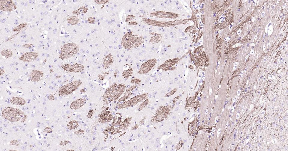 NF-H Recombinant Rabbit mAb (一抗) - IHC-P,IHC-F,IF | Bioss