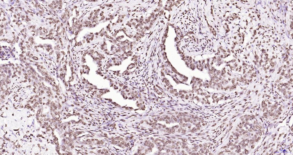 磷酸化蛋白酪氨酸激酶JAK-2重组兔单抗