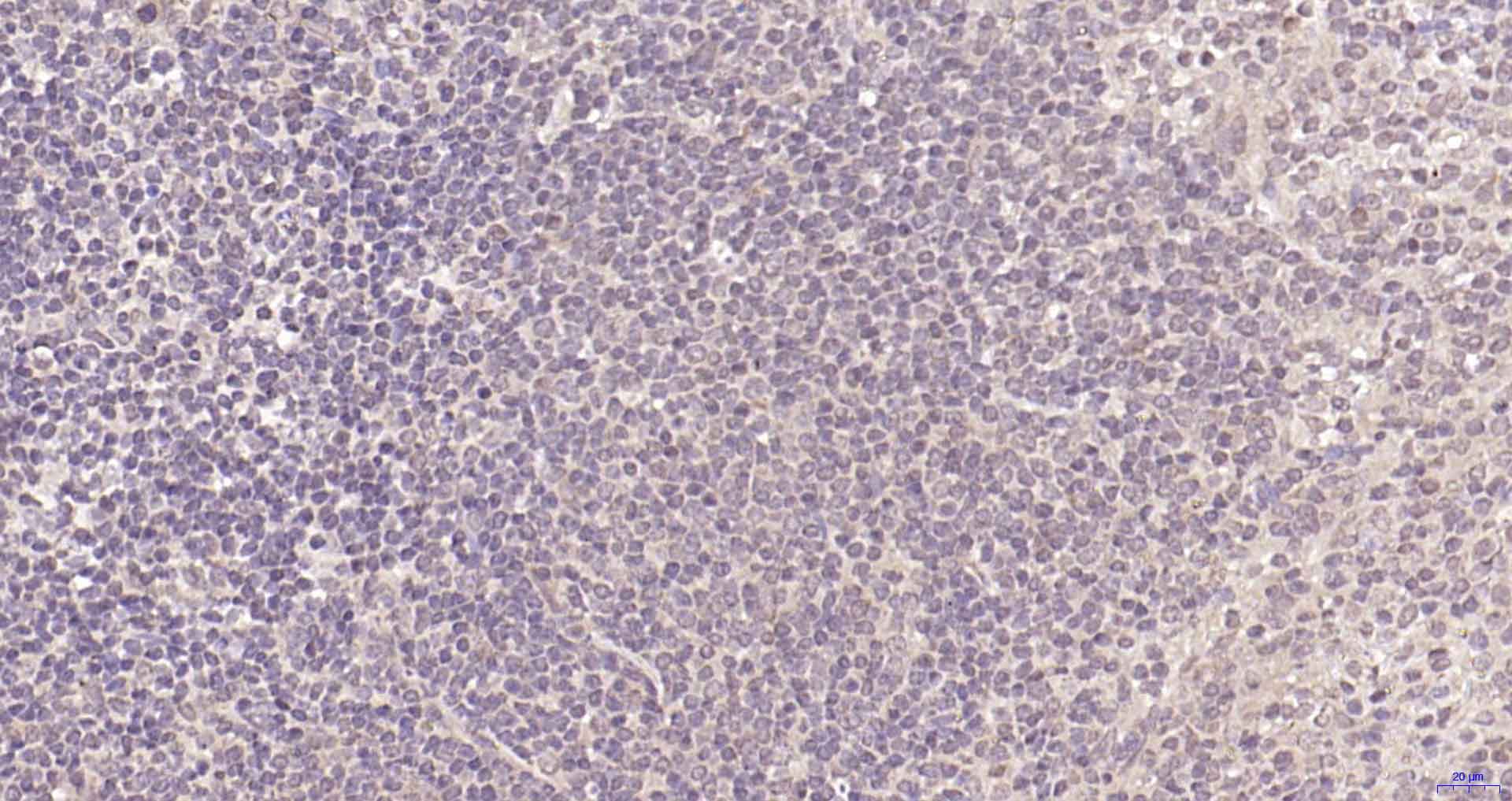 磷脂酰肌醇激酶p85β重组兔单抗