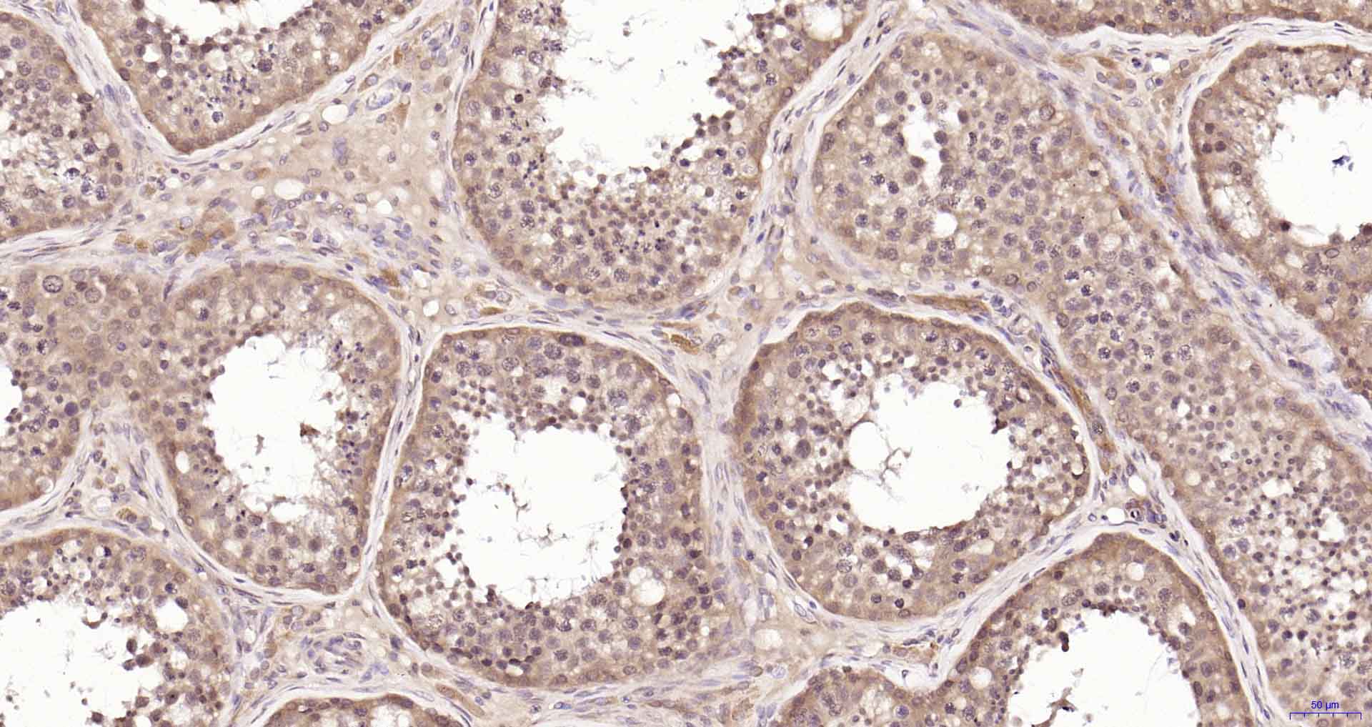 磷脂酰肌醇激酶p85β重组兔单抗