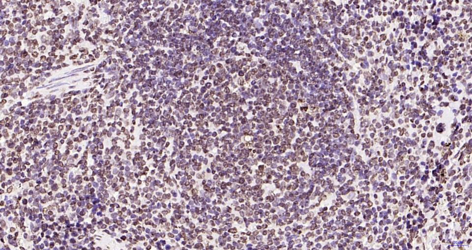 磷酸化蛋白酪氨酸激酶JAK-2重组兔单抗