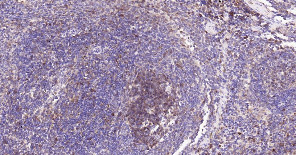 半胱胺酸蛋白酶蛋白-3重组兔单抗