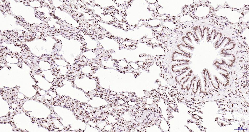磷酸化蛋白酪氨酸激酶JAK-2重组兔单抗
