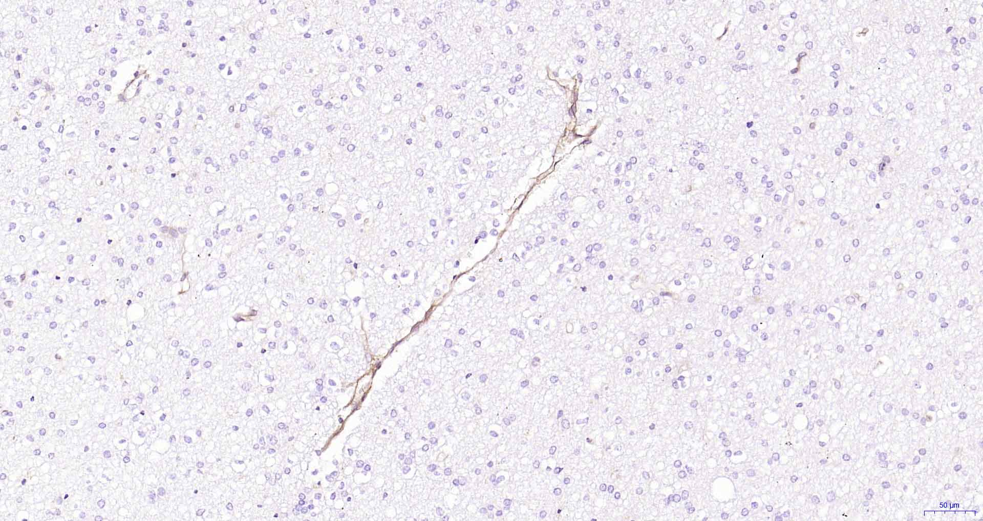 CD105重组兔单抗-bsm-61042R