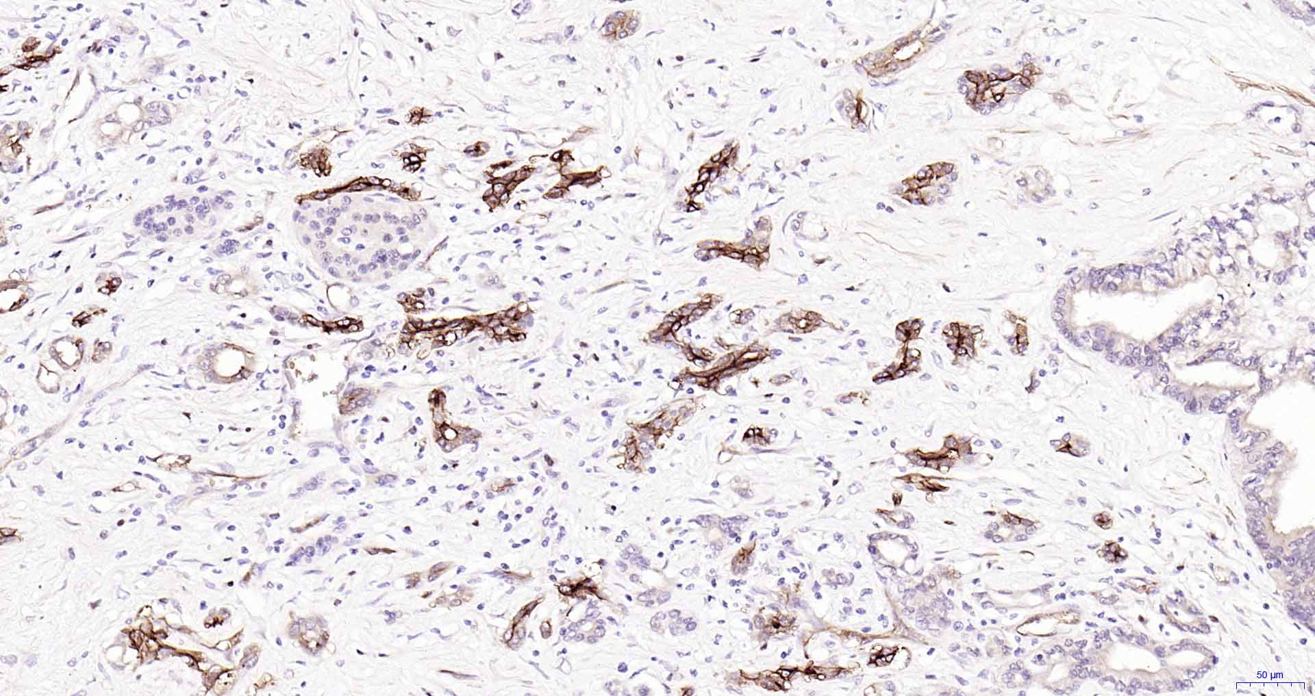 水通道蛋白1重组兔单抗