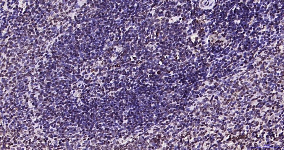 磷酸化蛋白酪氨酸激酶JAK-2重组兔单抗