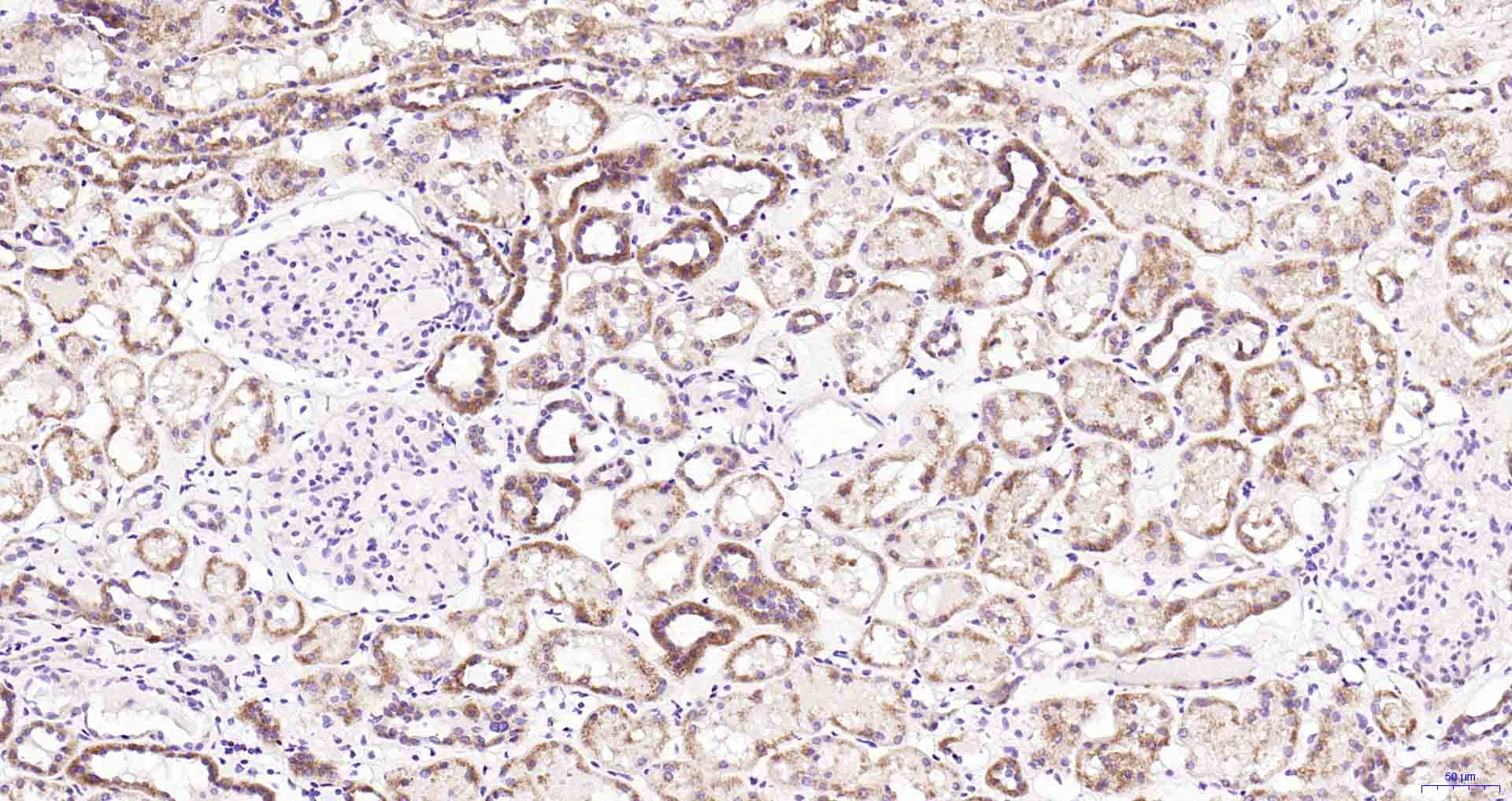 自噬相关蛋白1重组兔单抗-bsm-61039R