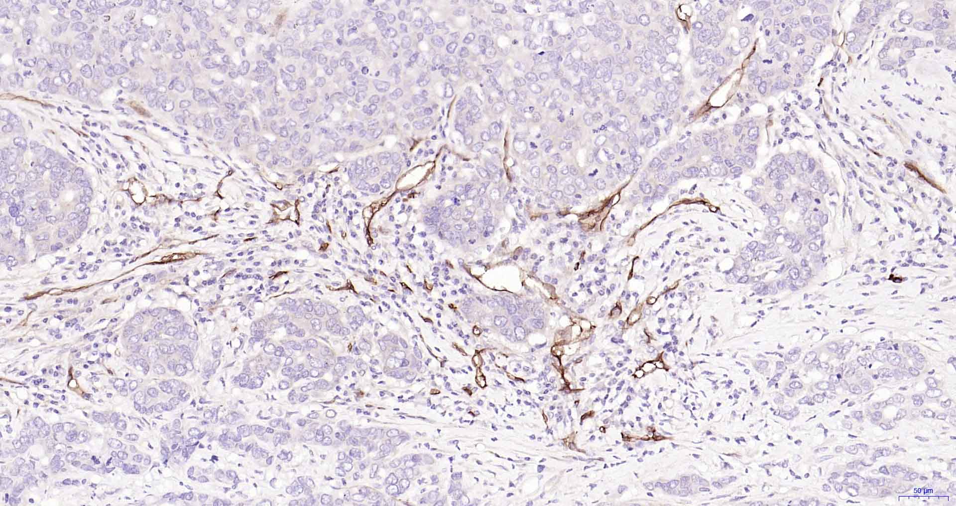 CD105重组兔单抗-bsm-61042R