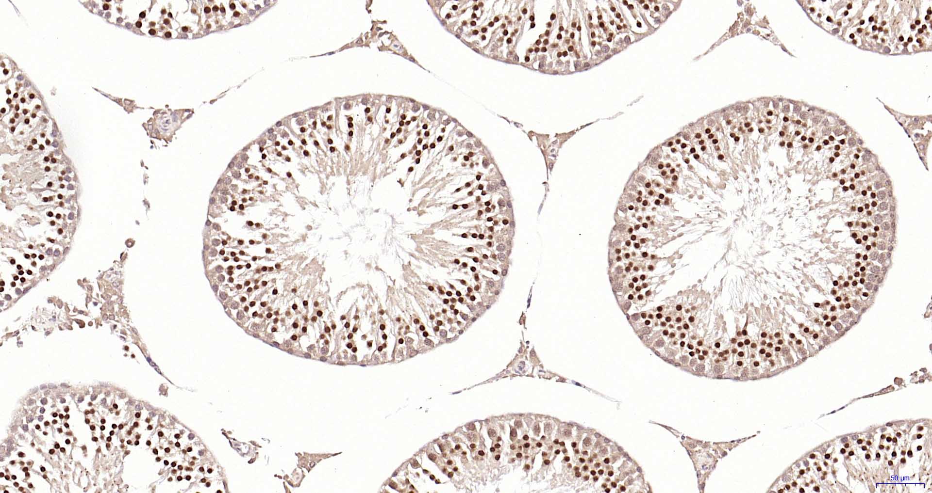 磷脂酰肌醇激酶p85β重组兔单抗