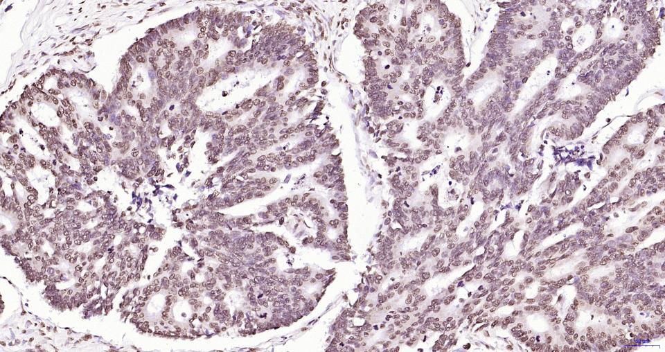 磷酸化蛋白酪氨酸激酶JAK-2重组兔单抗