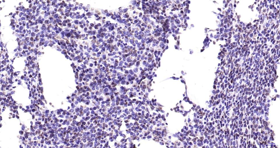 磷酸化蛋白酪氨酸激酶JAK-2重组兔单抗