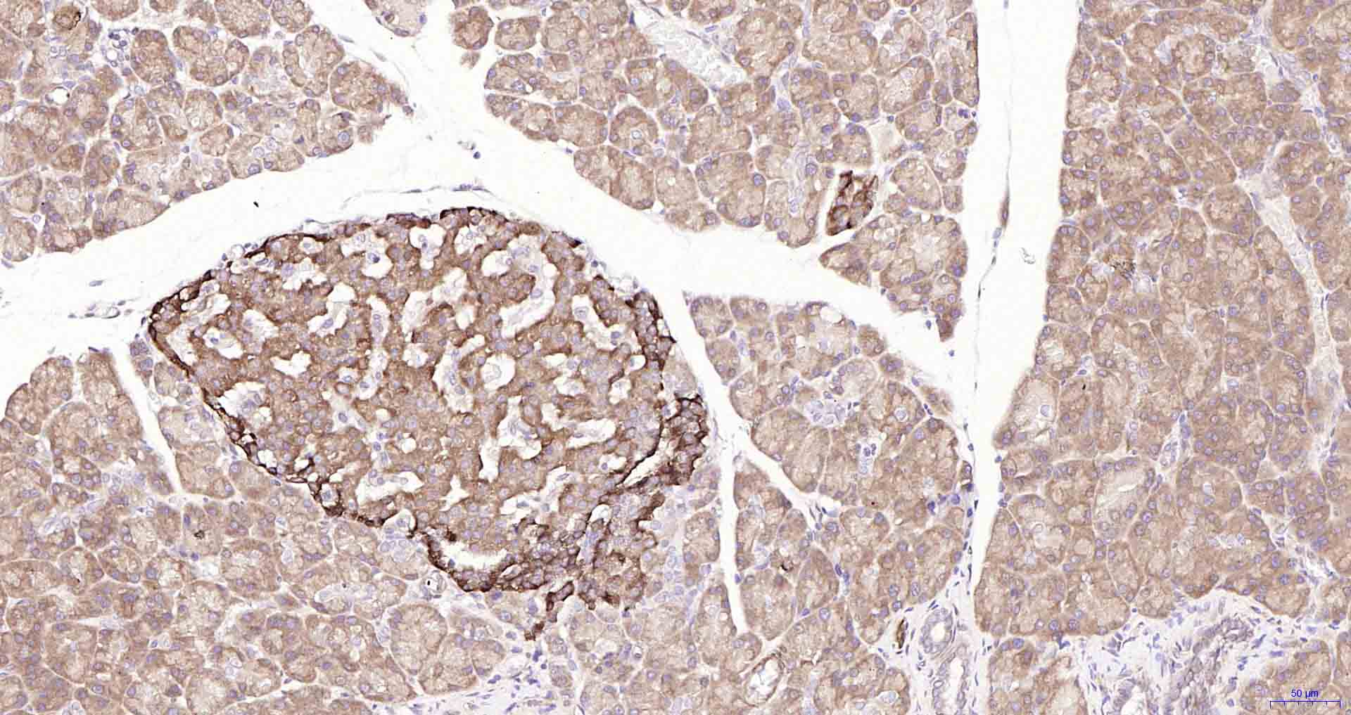 自噬相关蛋白1重组兔单抗-bsm-61039R