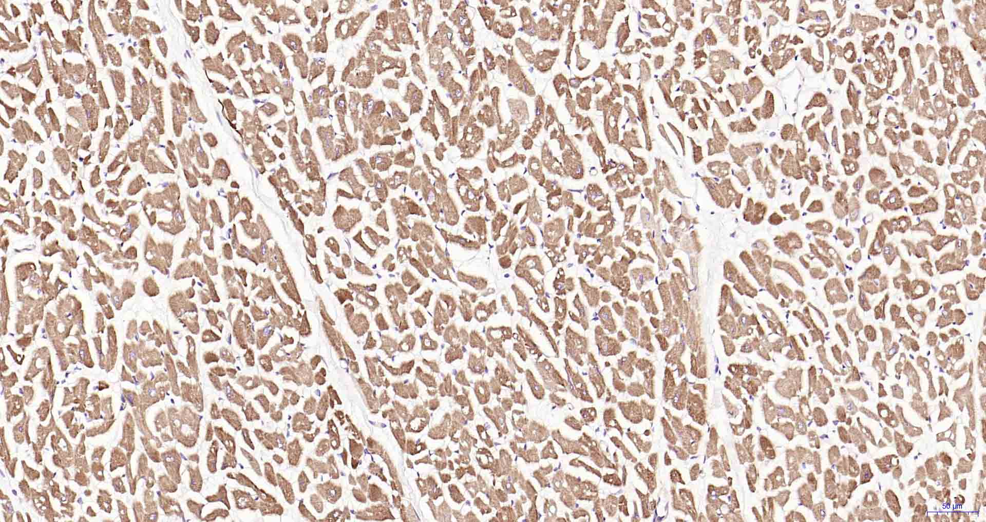 自噬相关蛋白1重组兔单抗-bsm-61039R