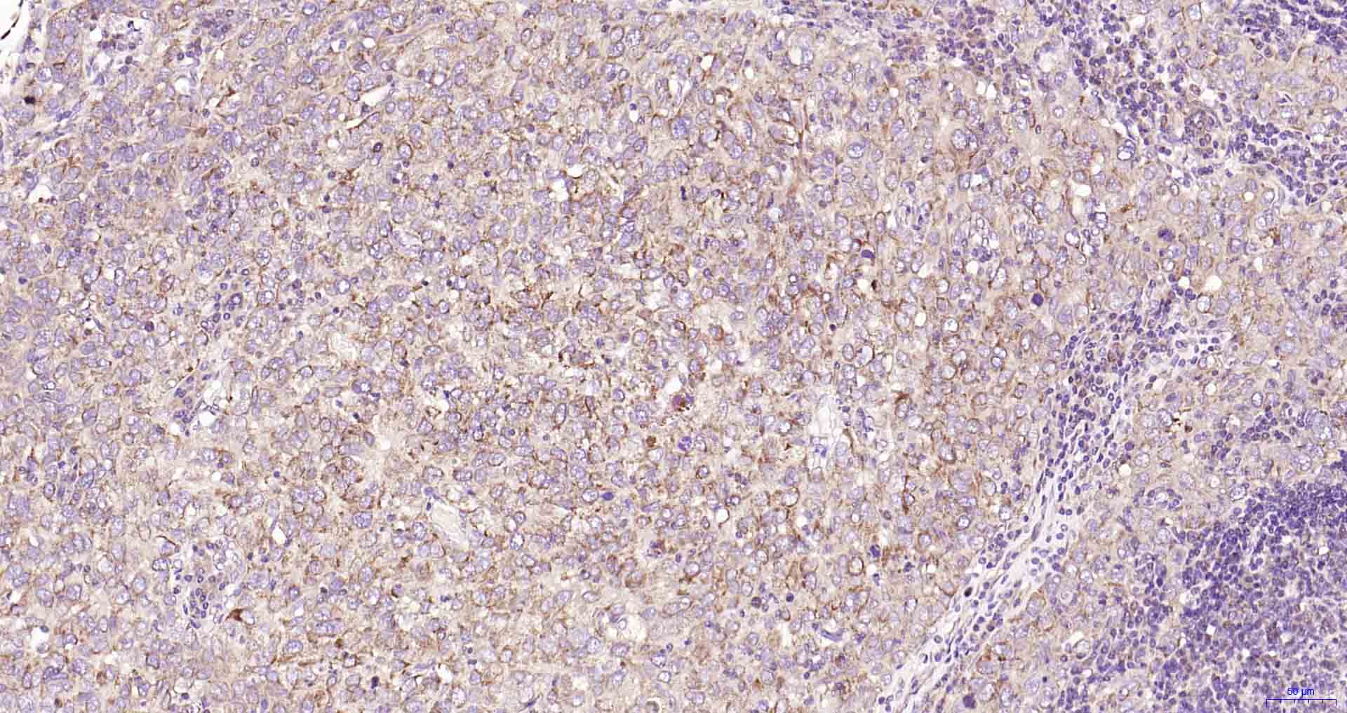 自噬相关蛋白1重组兔单抗-bsm-61039R