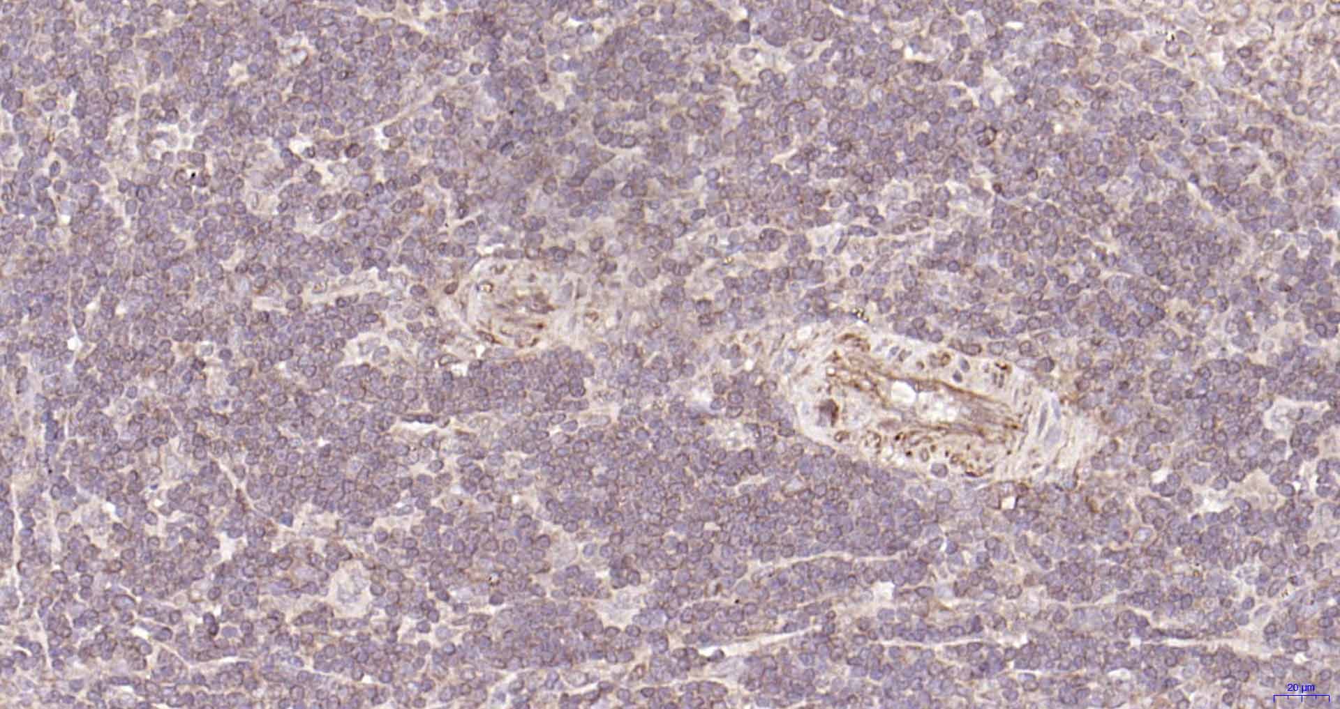 自噬相关蛋白1重组兔单抗-bsm-61039R