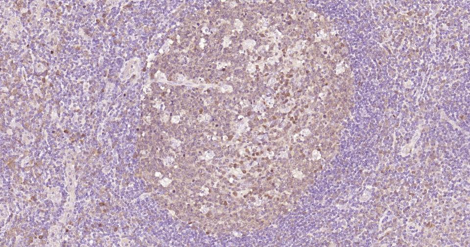 半胱胺酸蛋白酶蛋白-3重组兔单抗