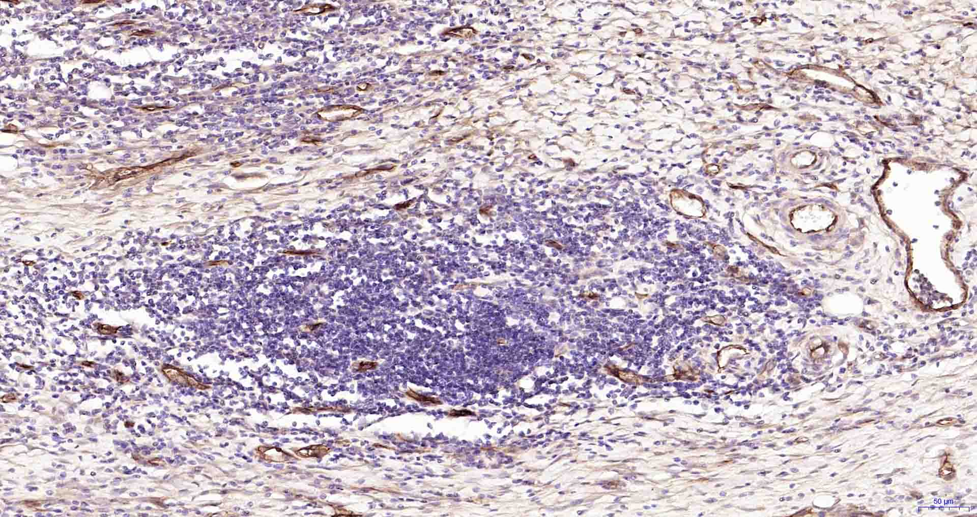 CD105重组兔单抗-bsm-61042R