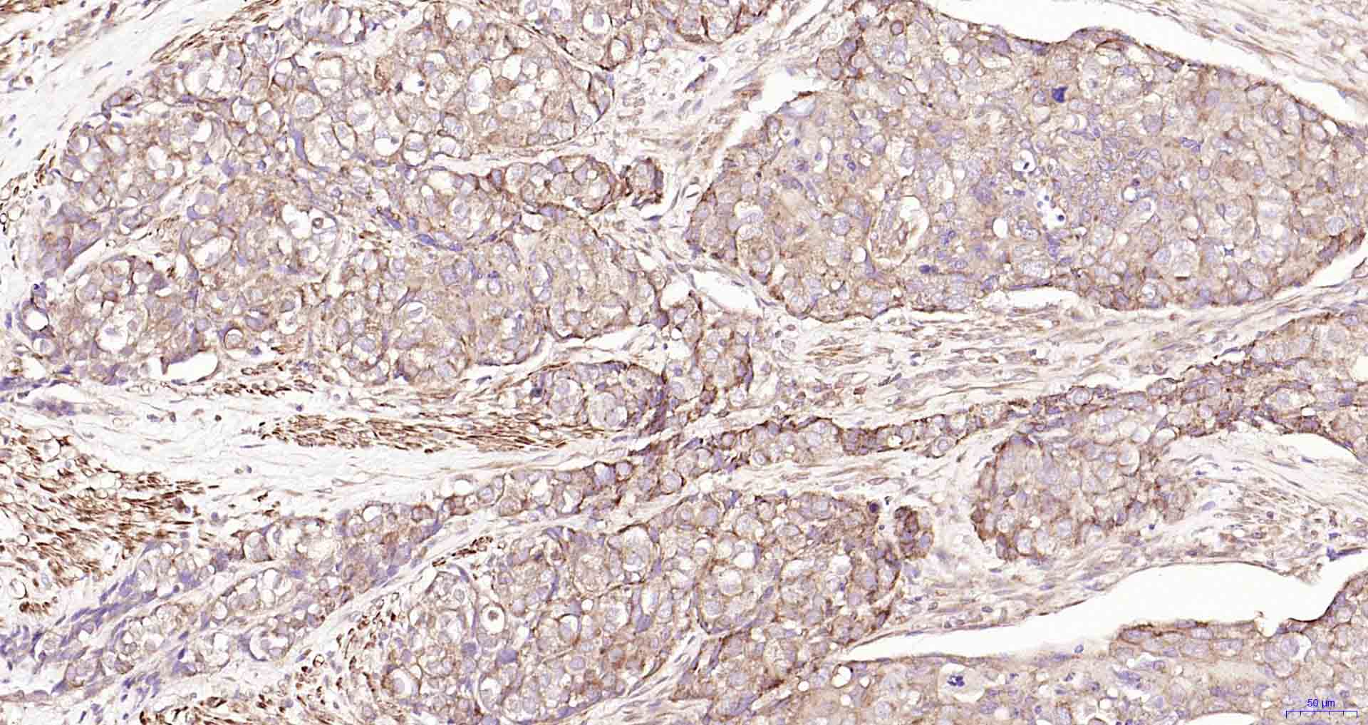 自噬相关蛋白1重组兔单抗-bsm-61039R