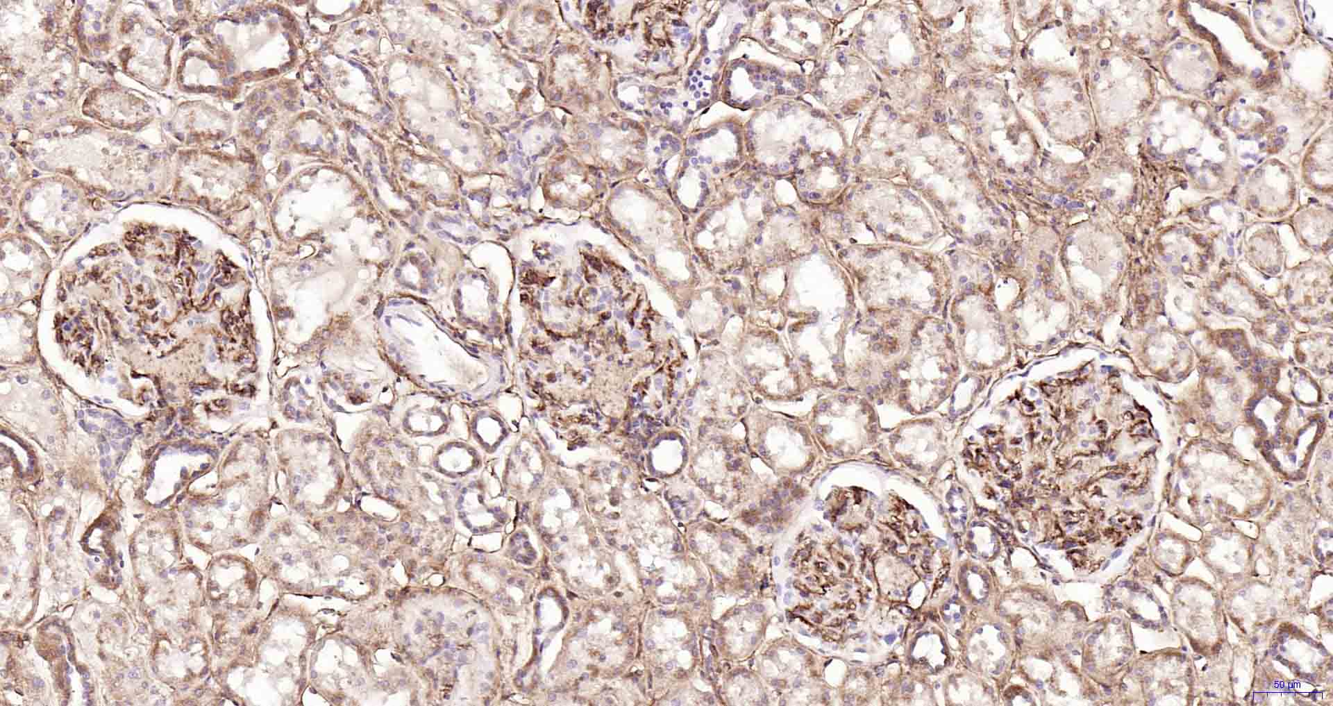 CD105重组兔单抗-bsm-61042R