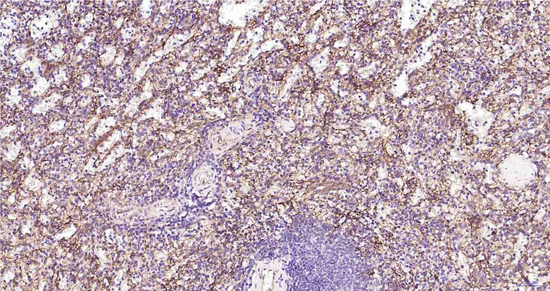CD105 Recombinant Rabbit mAb (一抗) - IHC-P,IHC-F,IF | Bioss