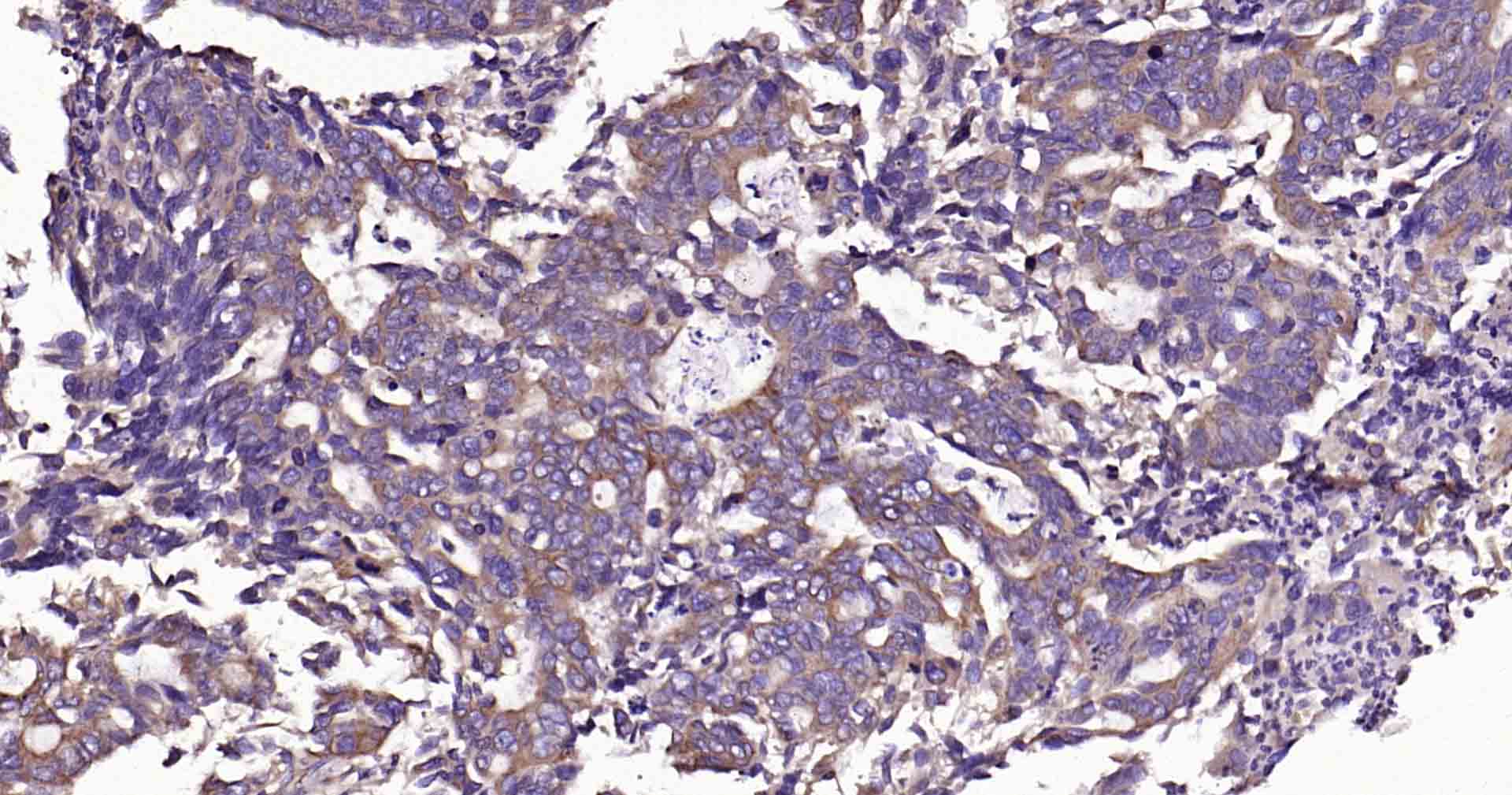 蛋白酪氨酸磷酸酶-1B重组兔单抗