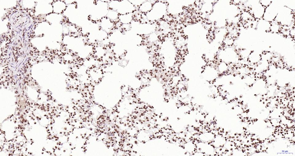 磷酸化蛋白酪氨酸激酶JAK-2重组兔单抗