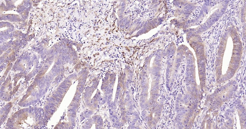 神经元特异性烯醇化酶/γ 烯醇化酶重组兔单克隆抗体