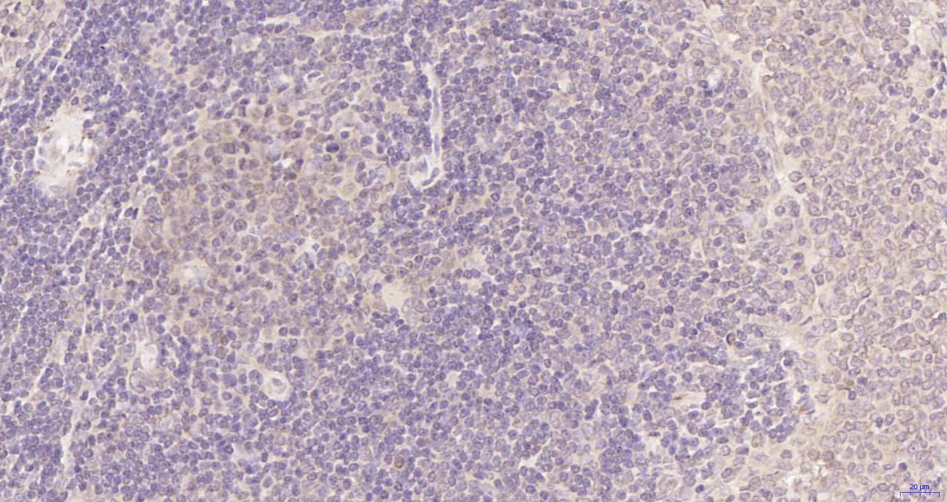 磷脂酰肌醇激酶p85β重组兔单抗