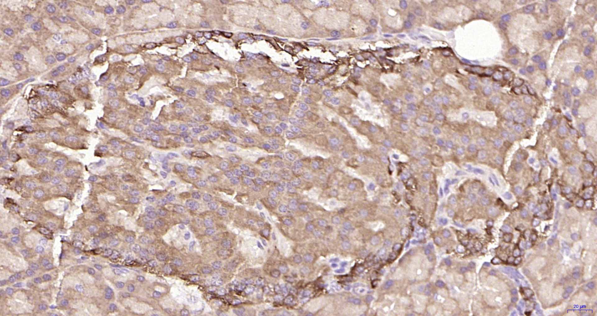自噬相关蛋白1重组兔单抗-bsm-61039R