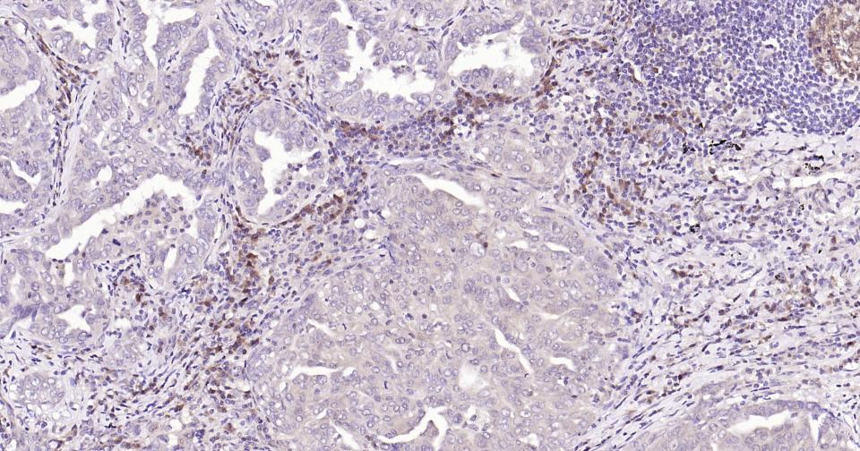 半胱胺酸蛋白酶蛋白-3重组兔单抗