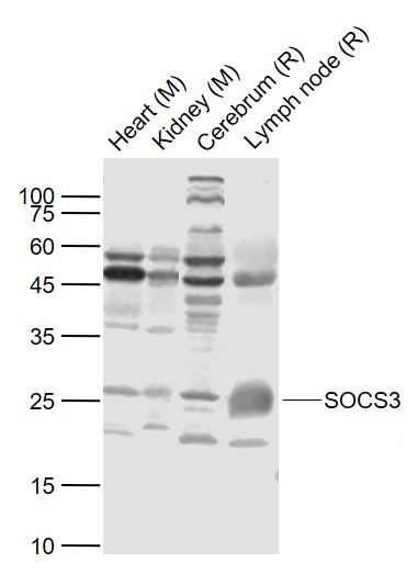 SOCS3 Rabbit pAb (一抗) | Bioss