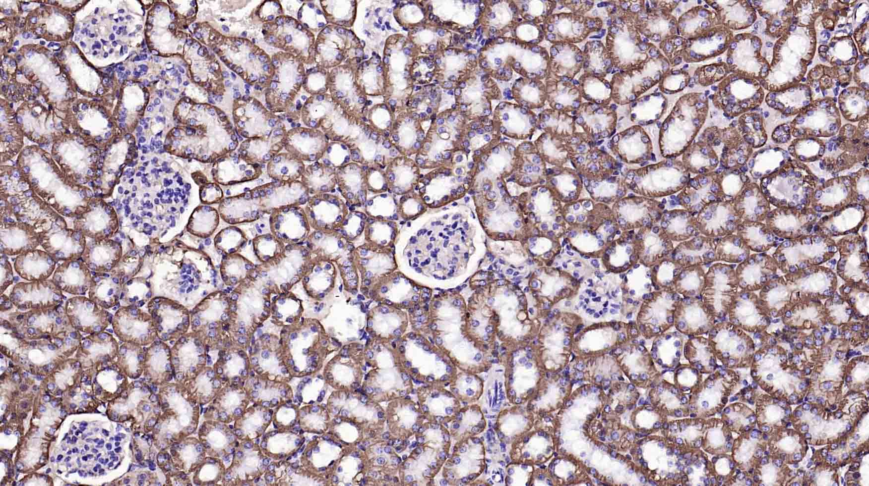 钠钾ATP酶蛋白a1单克隆抗体-bsm-34014M