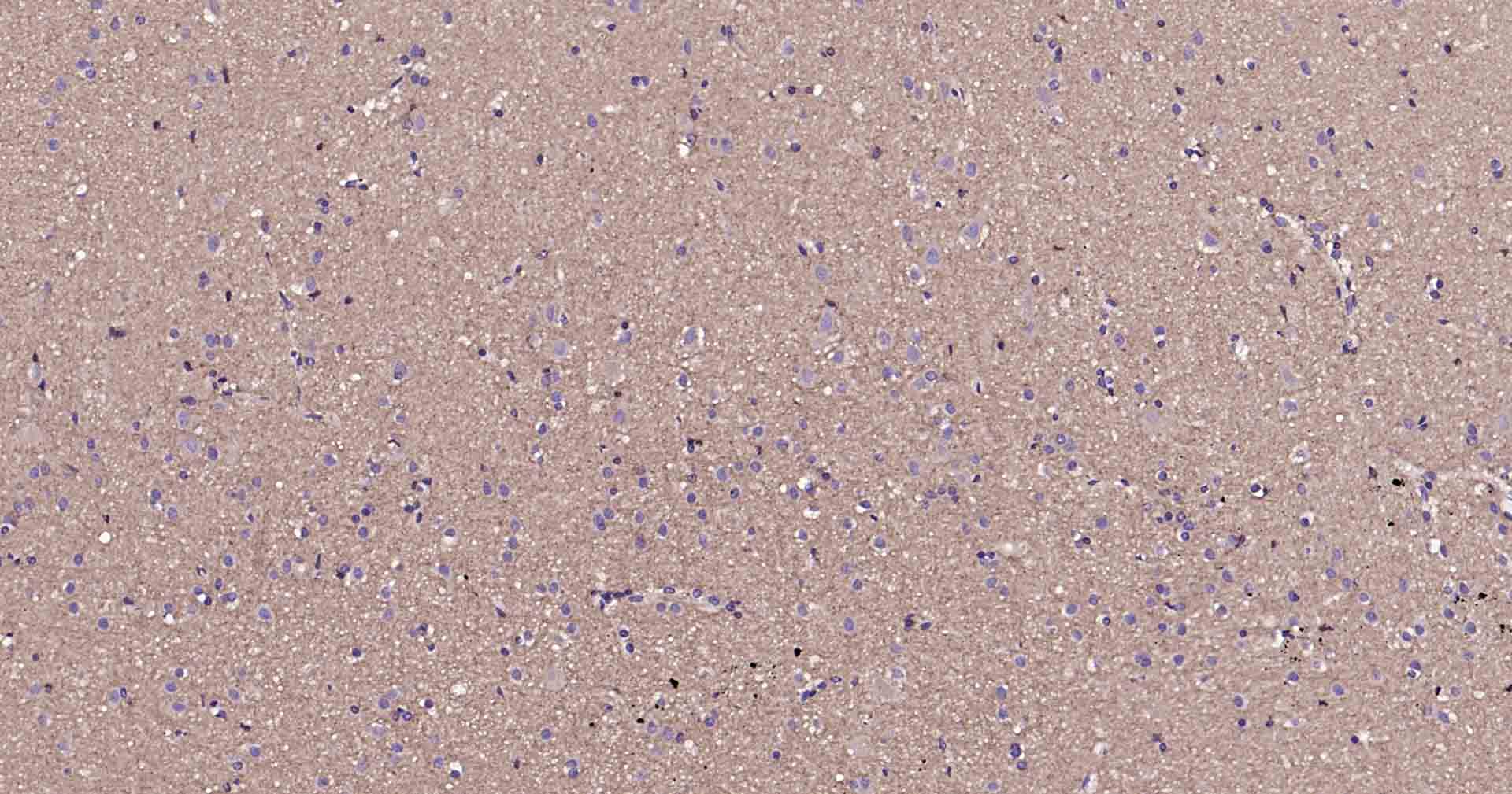 Ras样蛋白A重组兔单抗