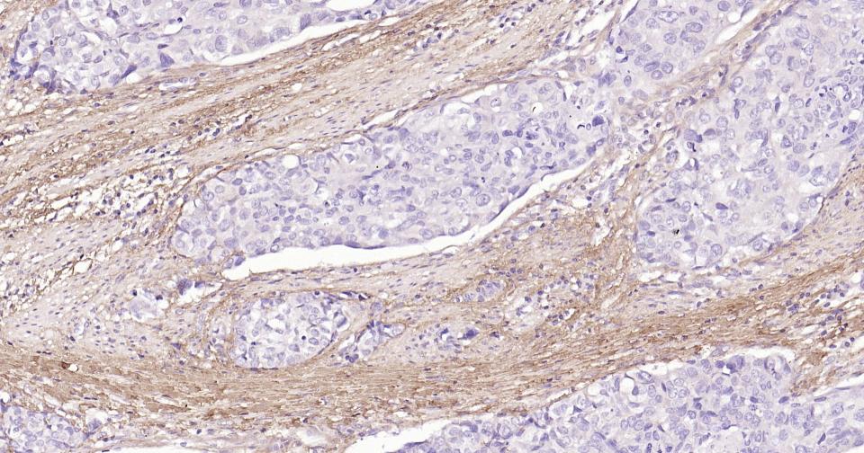 I型胶原单克隆抗体-bsm-33401M