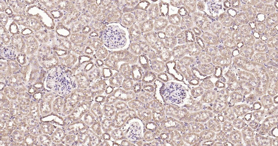 钙网蛋白重组兔单抗
