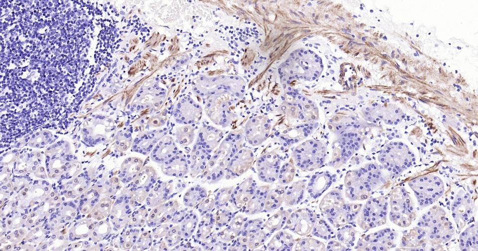 钙调节蛋白-1重组兔单克隆抗体