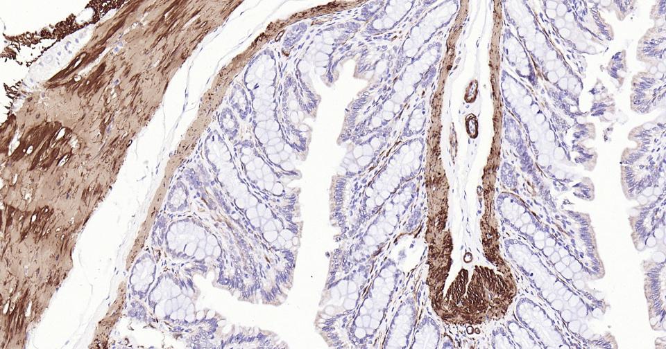 钙调节蛋白-1重组兔单克隆抗体