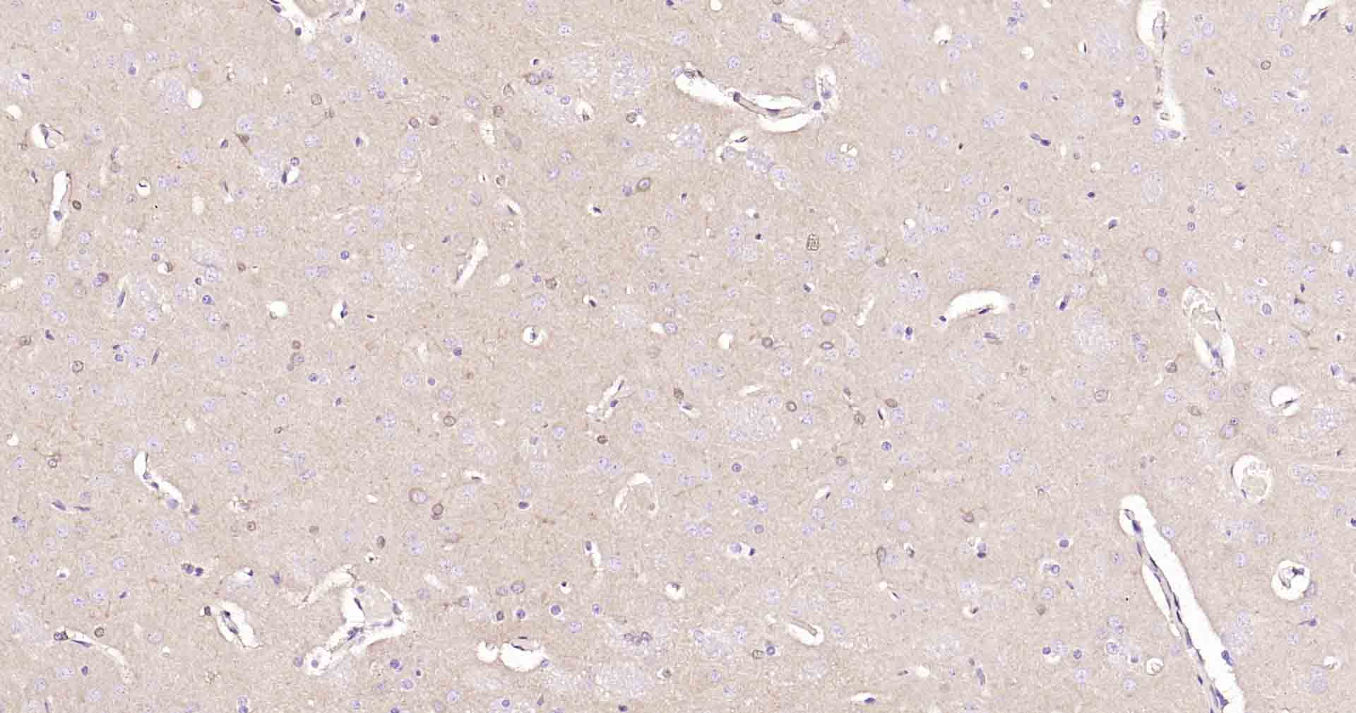 神经元特异性烯醇化酶/γ 烯醇化酶重组兔单克隆抗体