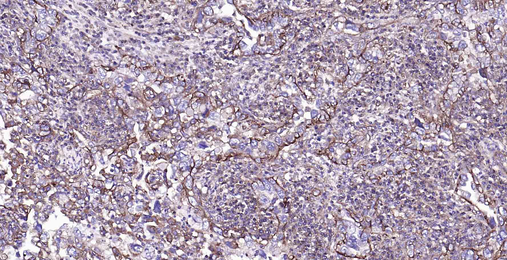 钠钾ATP酶蛋白a1单克隆抗体-bsm-34014M