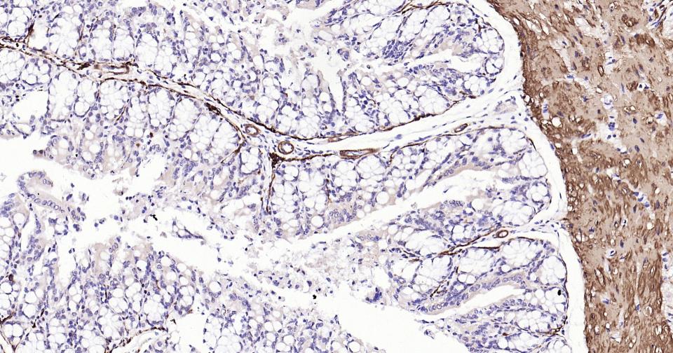 钙调节蛋白-1重组兔单克隆抗体