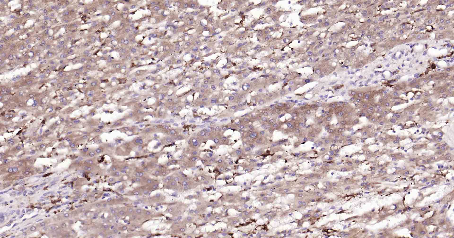 自噬效应蛋白Beclin 1重组兔单抗