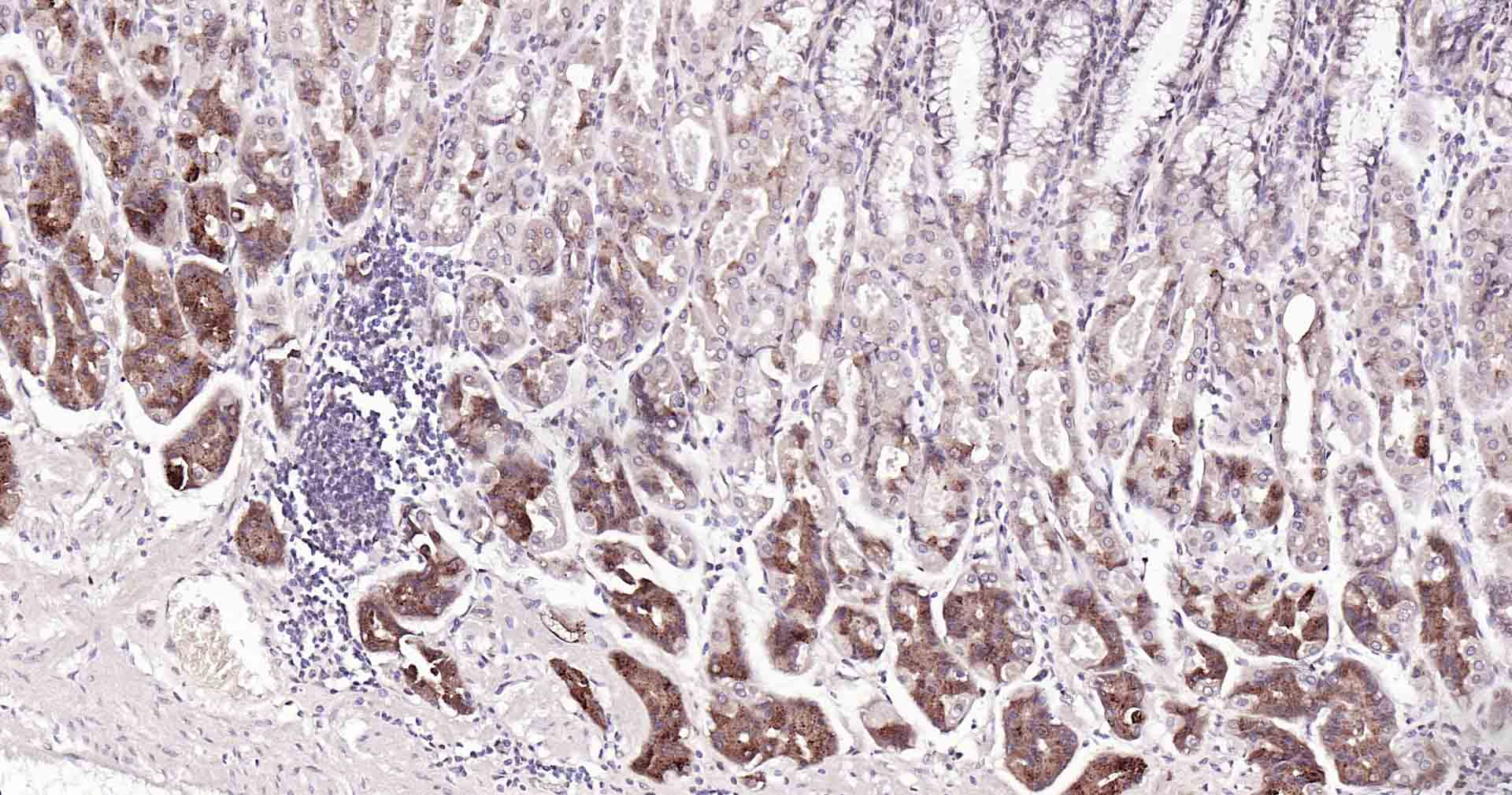 磷脂酰肌醇激酶（PI3Kβ）重组兔单抗