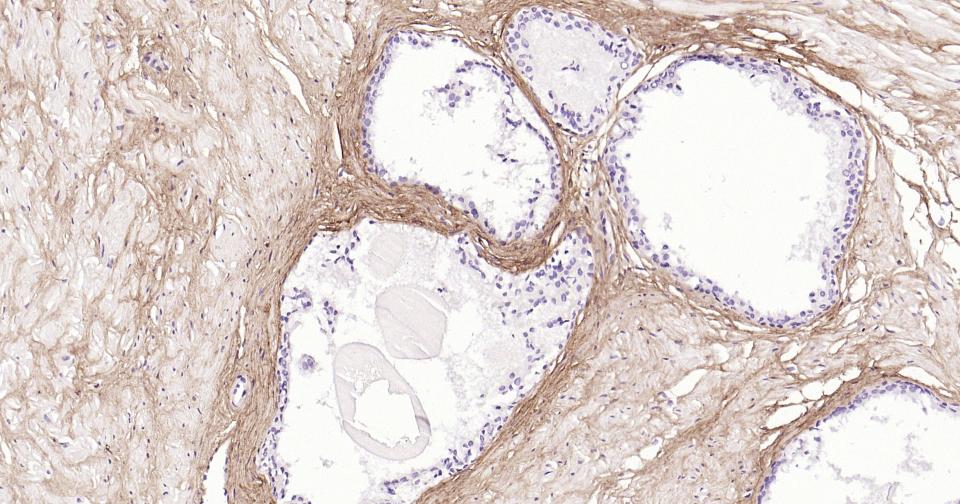 I型胶原单克隆抗体-bsm-33401M