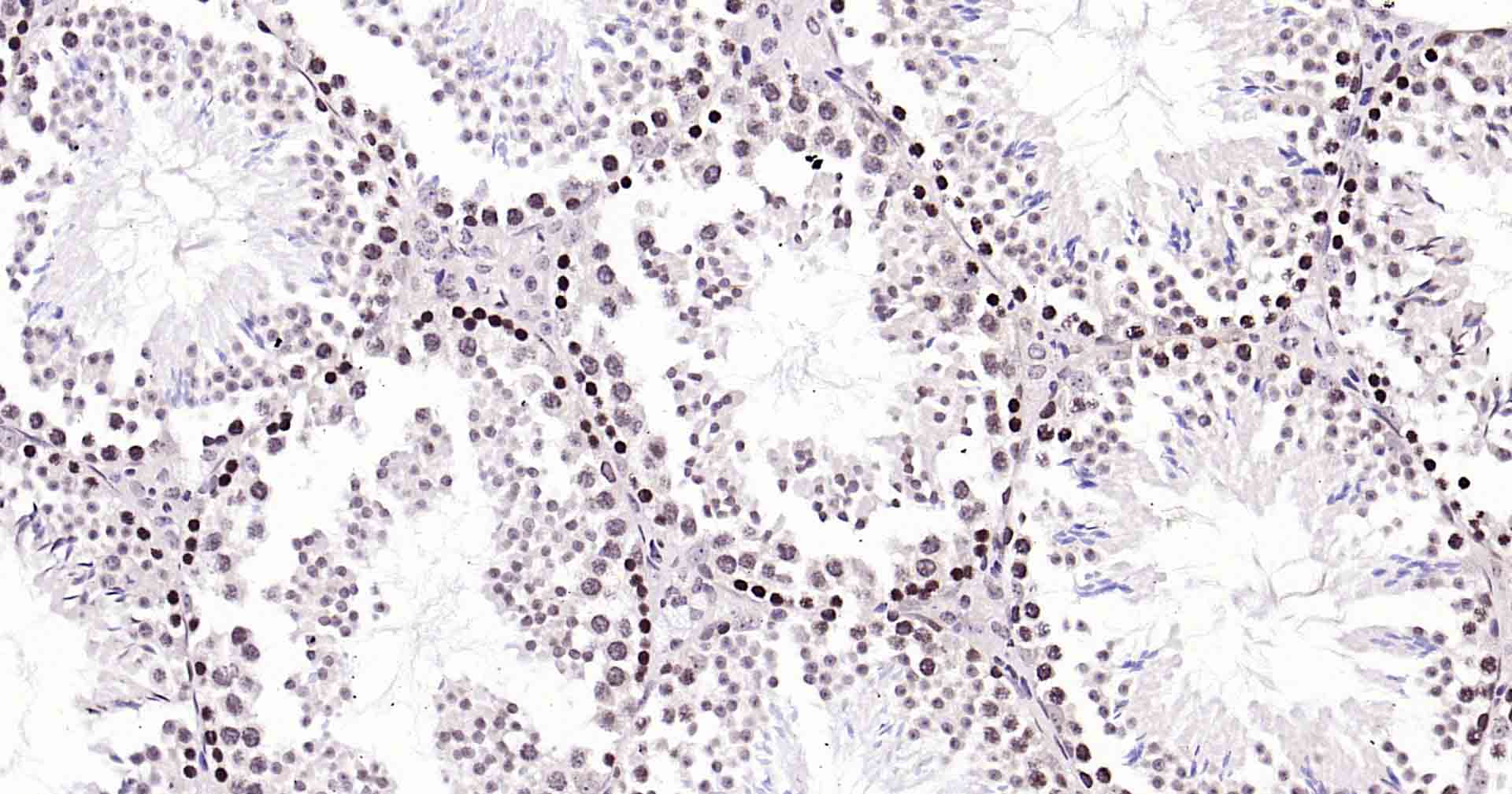 Rad51重组兔单抗