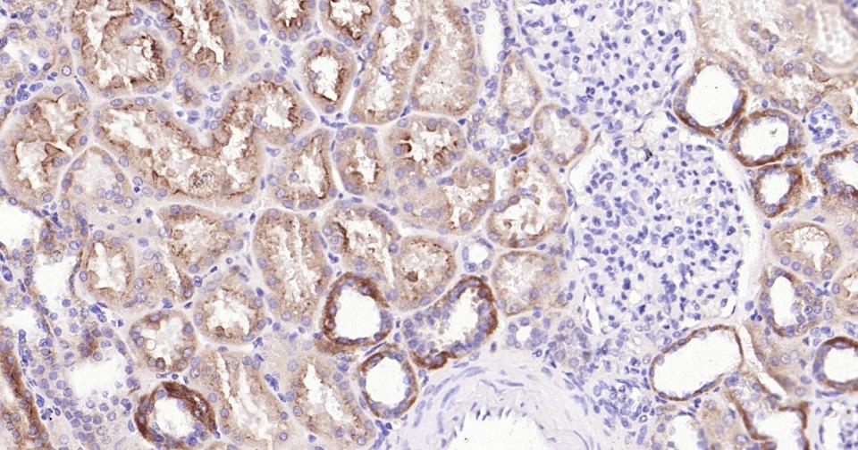 糖蛋白gp330重组兔单抗