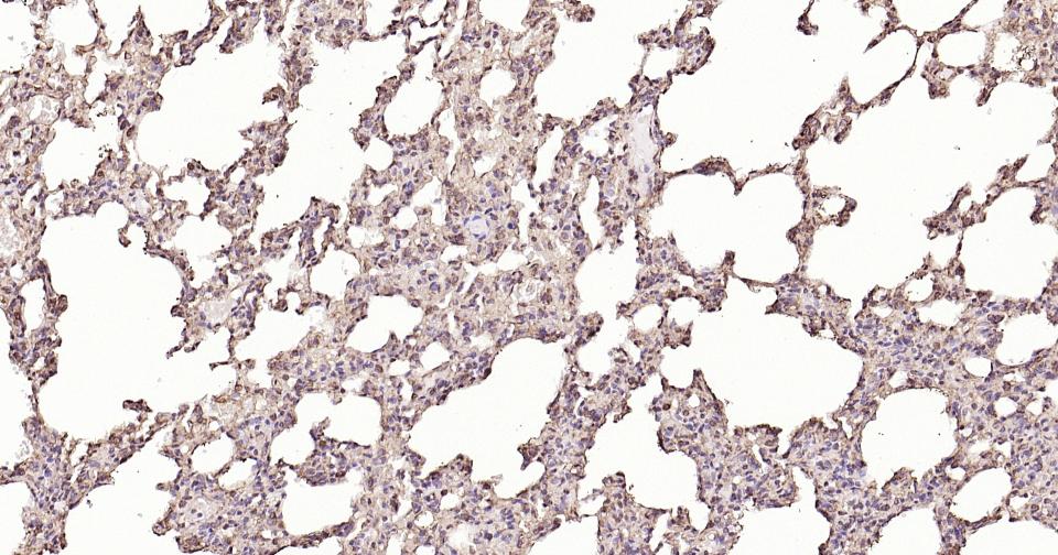 钙网蛋白重组兔单抗