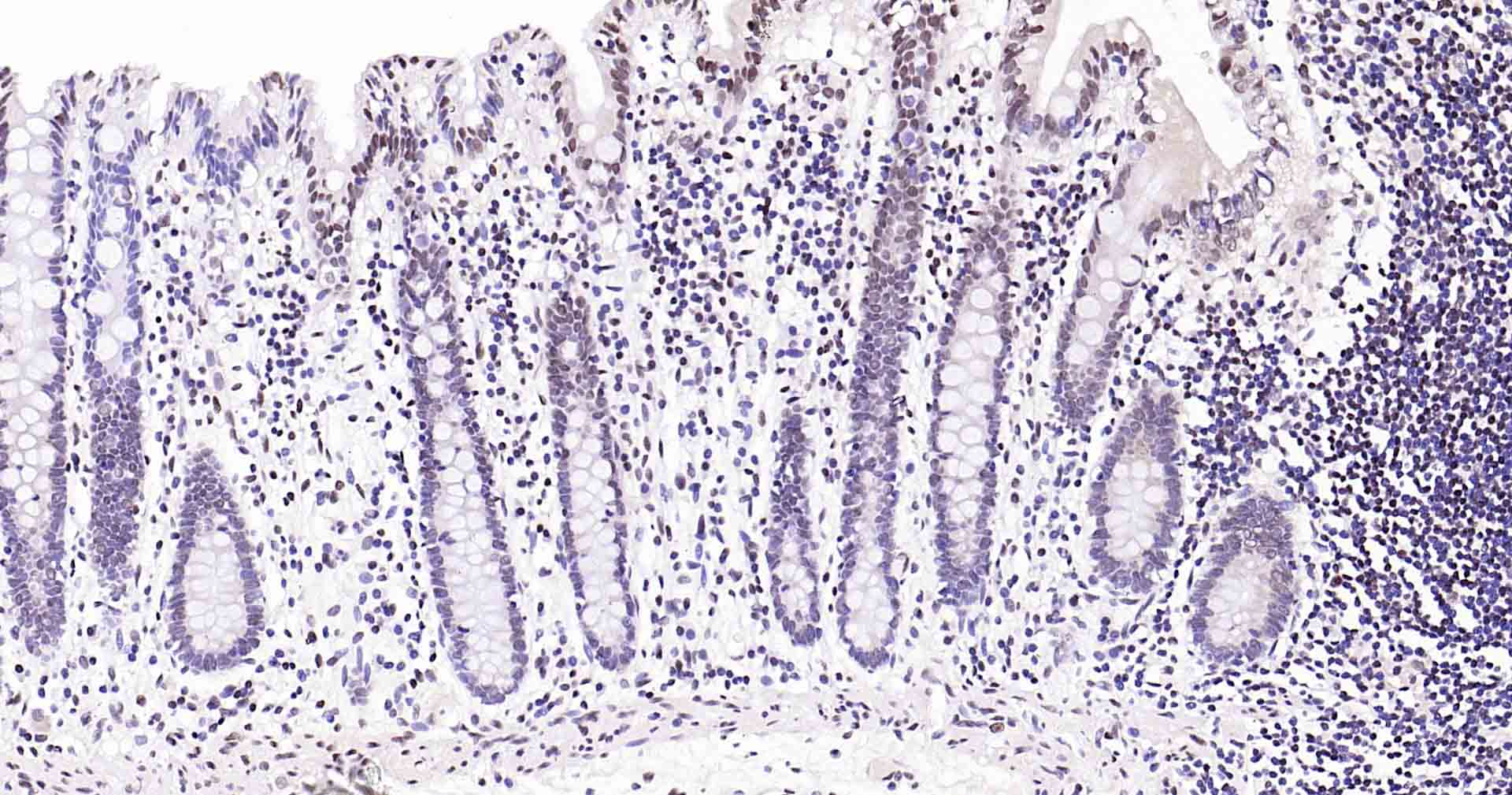 Rad51重组兔单抗